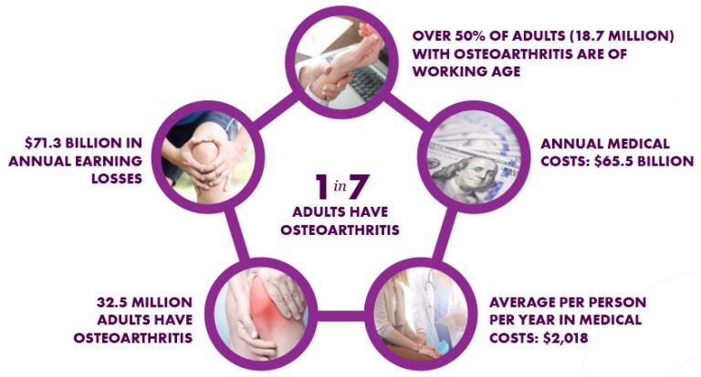 1 in 7 Adults have Osteoarthritis